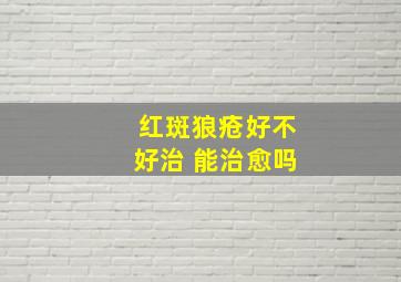 红斑狼疮好不好治 能治愈吗